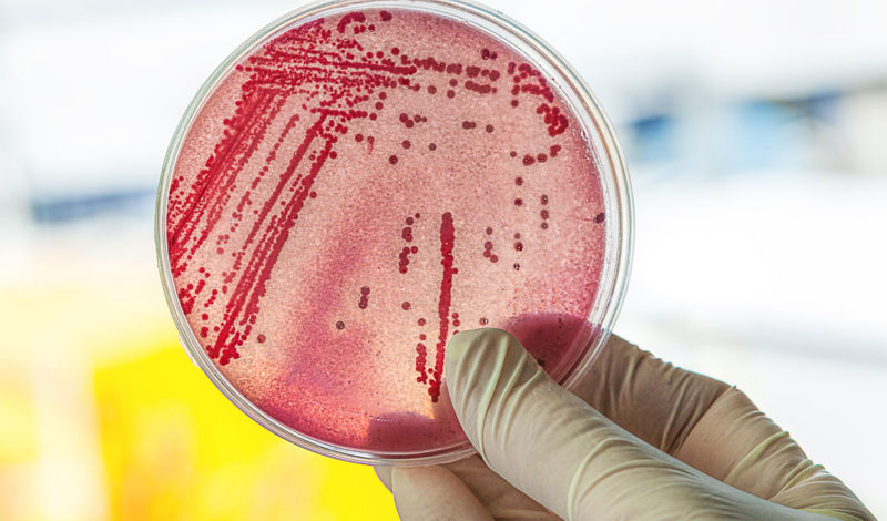 E-coli-Bakterien - das machen sie im Darm